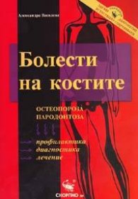 Болести на костите: Остеопороза, пародонтоза