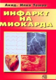 Инфаркт на миокарда/Знание