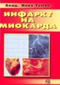 Инфаркт на миокарда/Знание