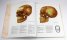 Anatomy of the Head: Anatomy, Mimic, Plasticity